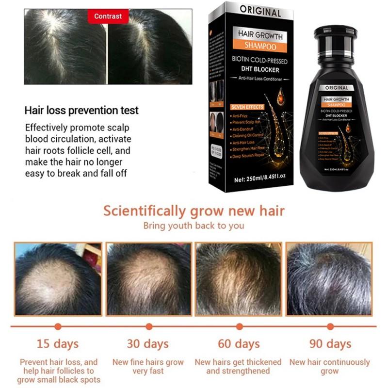 Pei Mei  Ginger Hair Growth Hair Thickening Hair Loss Treatments Shampoo 250ml