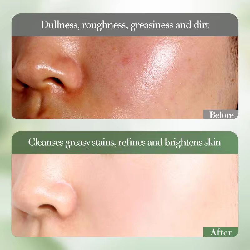 FAYANKOU Orange Extract Vitamin C Whitening Cleansing Wash Oil Control Hydrating and Smoothing Brightening Skin
