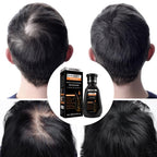 Pei Mei  Ginger Hair Growth Hair Thickening Hair Loss Treatments Shampoo 250ml