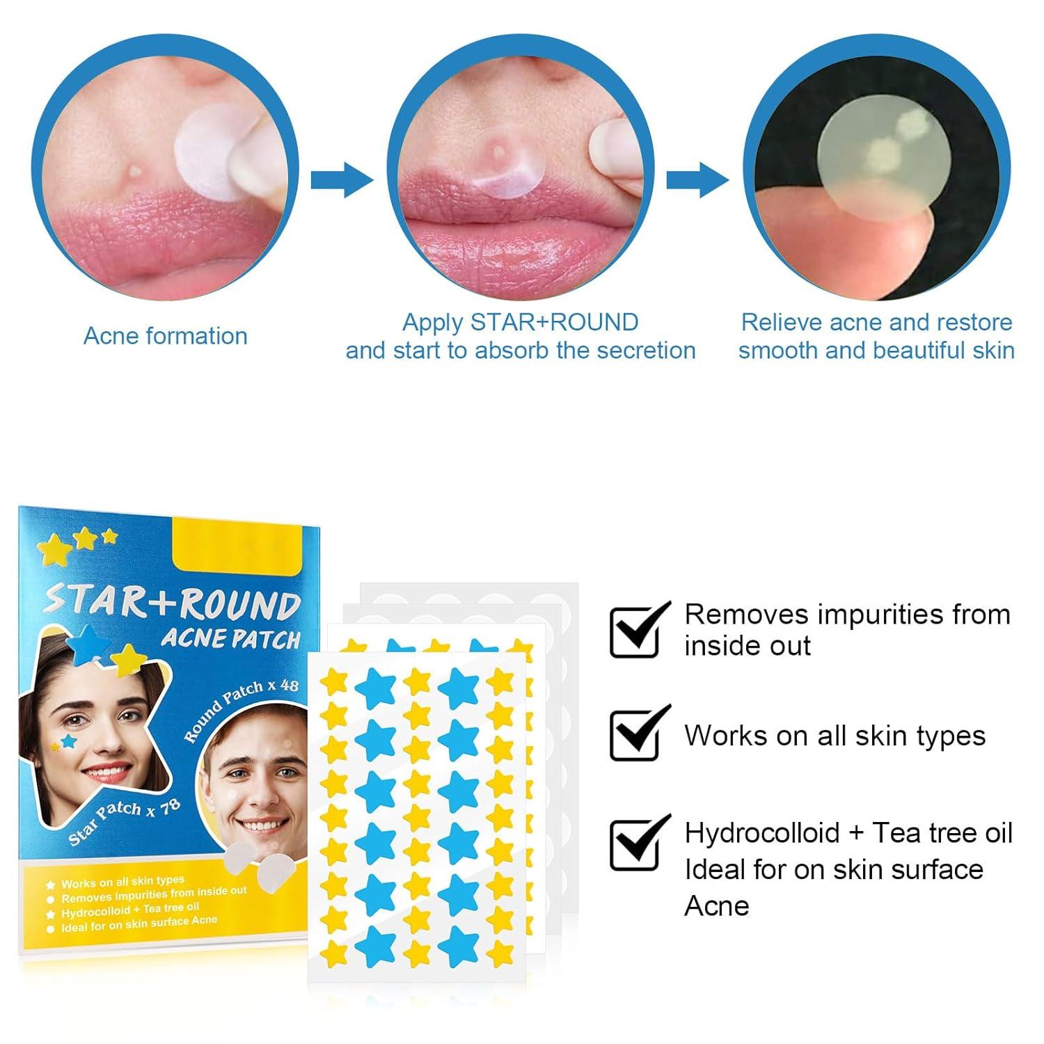 Sadoer Acne Patches Round Plus Star 36 Patches