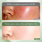 FAYANKOU Kiwifruit Extract Vitamin C Whitening Cleansing Wash Oil Control Hydrating and Smoothing Brightening Skin