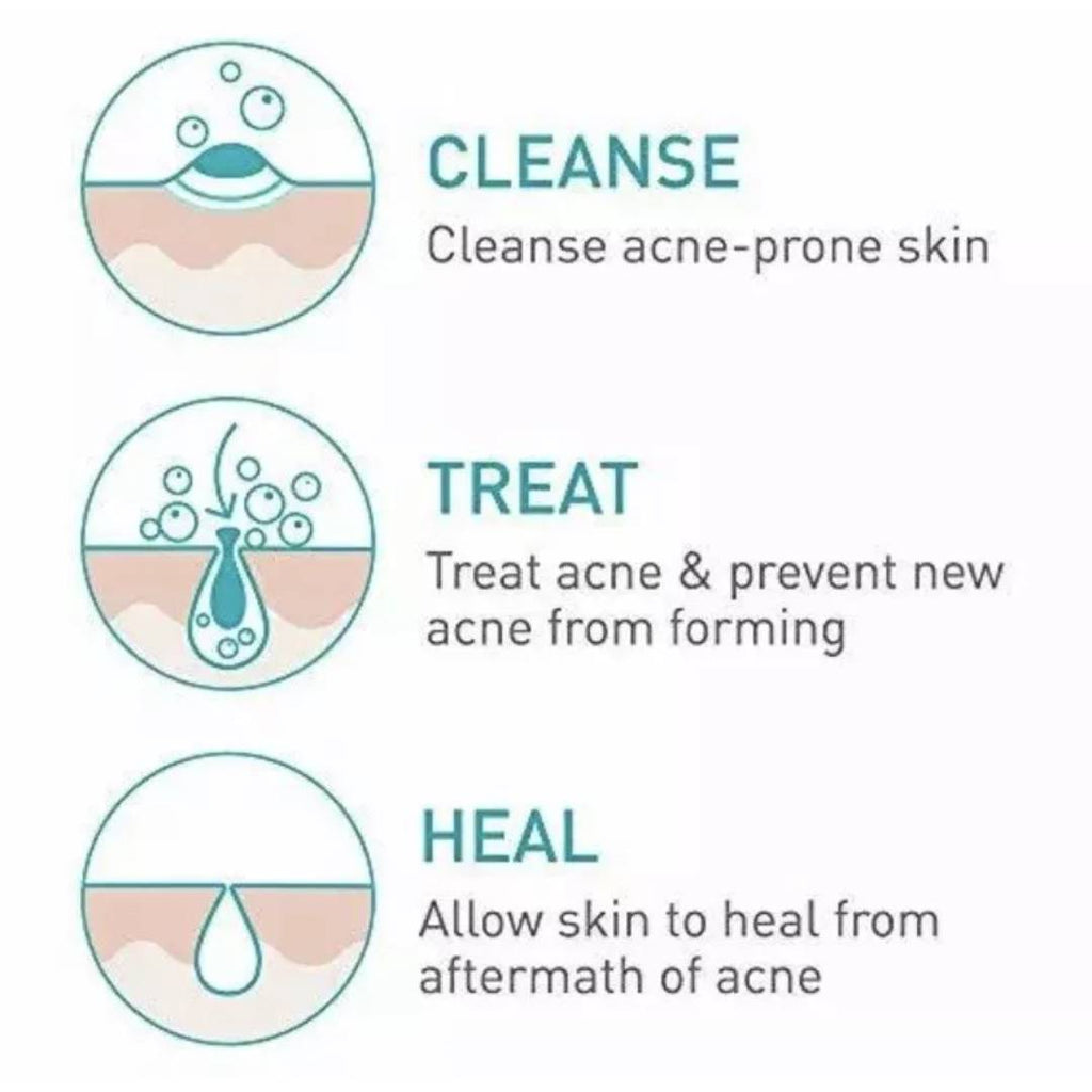 CERAVE ACNE FOAMING CLEANSER 4% BENZOYL PEROXIDE GEL 150ML