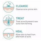 CERAVE ACNE FOAMING CLEANSER 4% BENZOYL PEROXIDE GEL 150ML
