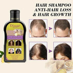 Disaar Ginger Hair Shampoo Anti Hair Loss Hair Growth