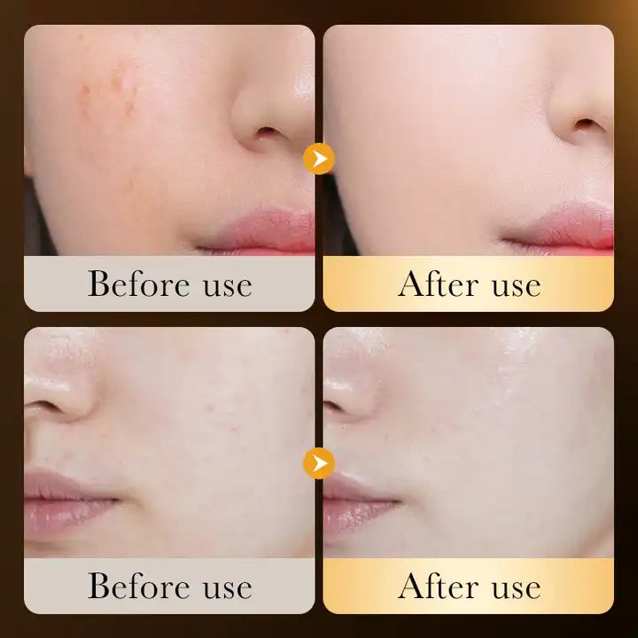 ZOZU Whitening Vitamin C Serum Skin Care Anti Aging 24k Gold Serum