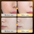 ZOZU Whitening Vitamin C Serum Skin Care Anti Aging 24k Gold Serum