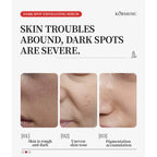 Kormesic Dark Spot Exfoliating Salicylic Acid Niacinamide AHA Serum 40ml