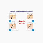 BIOAQUA Anti Acne Moisturizing Hyaluronic Acid Essence Mask