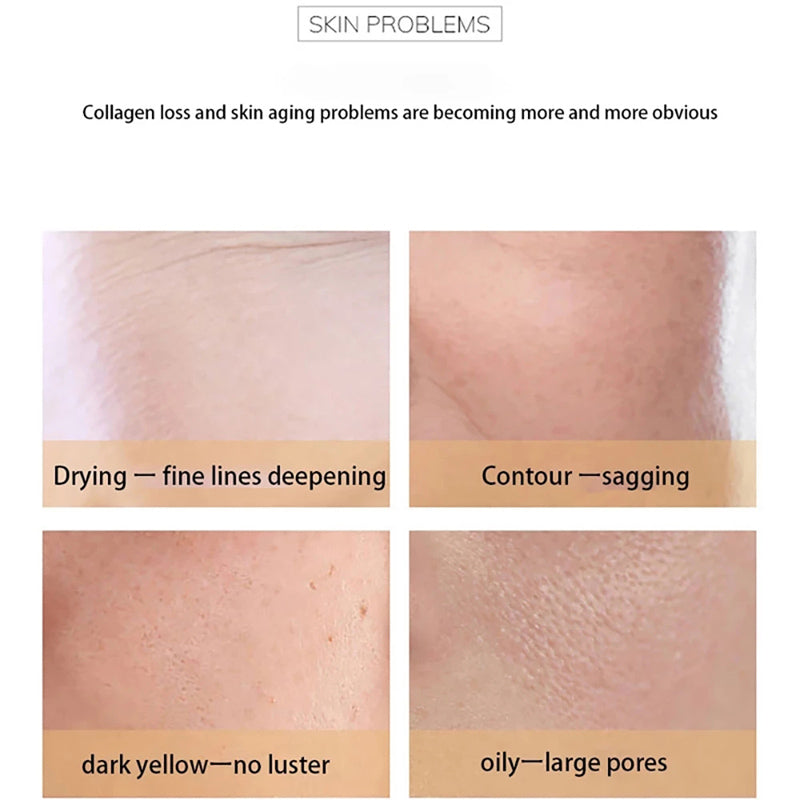 Baizton Collagen Pearl Cream Anti Aging Whitening Moisturizing Anti-drying Brighten Lifting Firming Anti Wrinkles Face Cream Skin Care