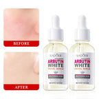 Sadoer Nicotinamide & Arbutin Whitening Face Serum 30ml