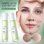 Sadoer 3% Salicylic Acid Skincare Dark Spot Acne Essence Lotion Niacinamide Repair Nourishing Whitening Brighten Moisturizing Lotion
