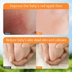 SADOER Calendula Vitamin E Gentle Soothing Baby Anti-Cracking Cream 50g