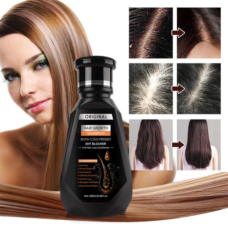 Pei Mei  Ginger Hair Growth Hair Thickening Hair Loss Treatments Shampoo 250ml