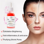 Aichun Beauty AHA 30% BHA 2% Exfoliation Face Serum 30ml