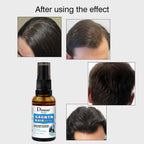 Disaar Hair Growth Strengthen Hair Root Spray – 30ml